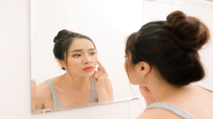 Mengatasi Kulit Wajah Yang Iritasi Akibat Pemakaian Skincare